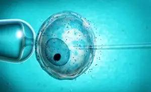 体外受精 IVF-ET